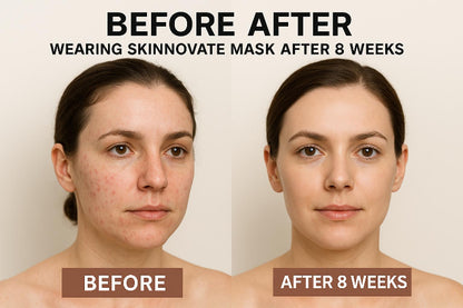 Skinnovate